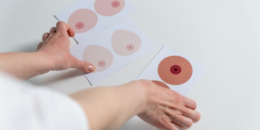 Tumore al Seno: Un’Analisi della Sfida Oncologica Globale