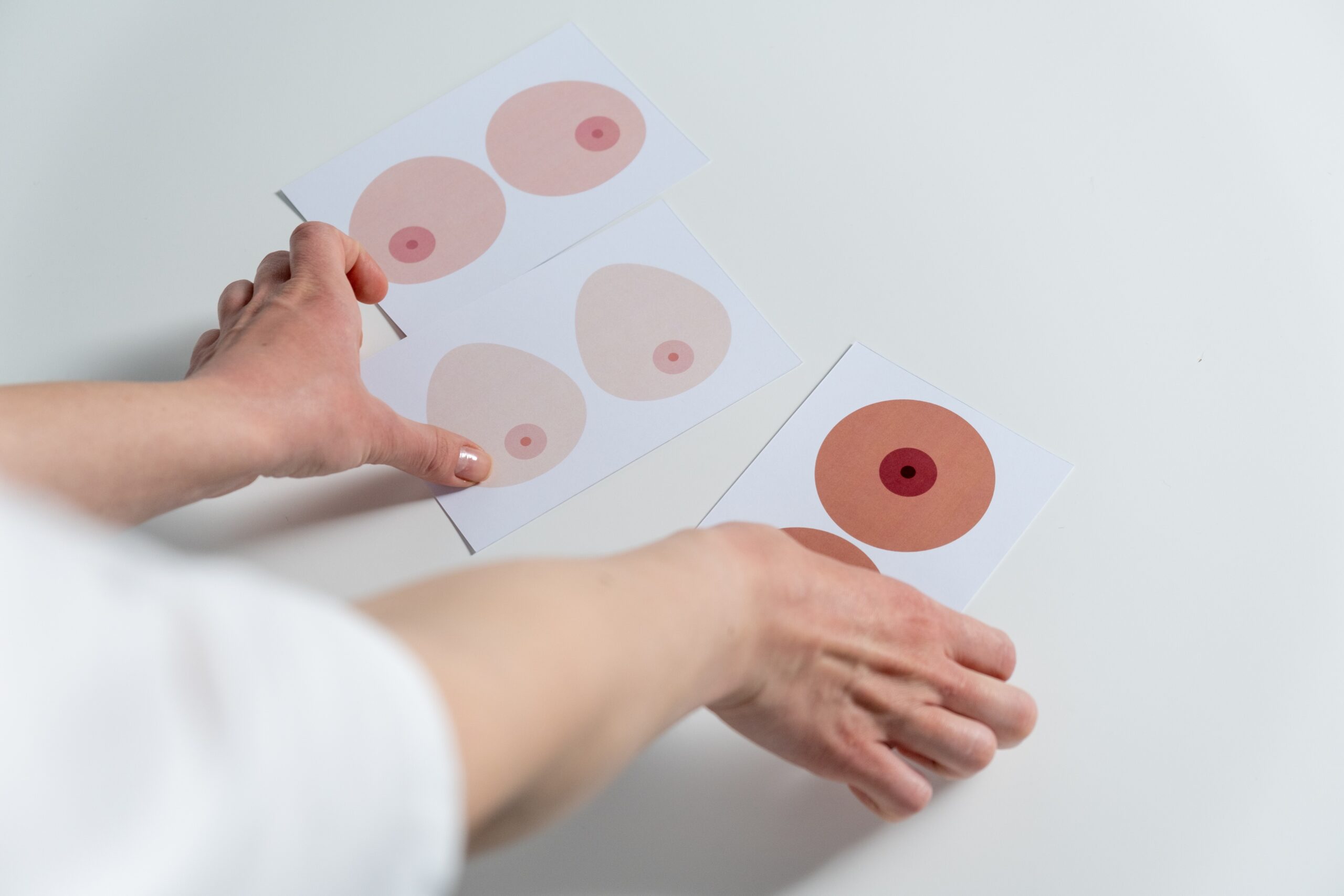 Tumore al Seno: Un’Analisi della Sfida Oncologica Globale