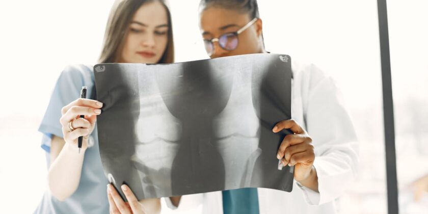 Tumore al Seno e Osteoporosi: la MOC aiuta a ridurre i rischi per le ossa