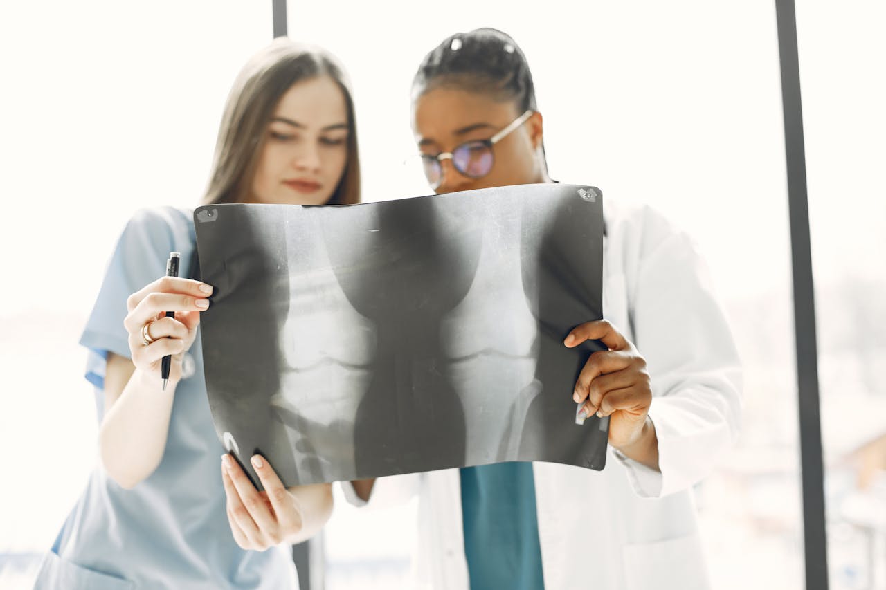 Tumore al Seno e Osteoporosi: la MOC aiuta a ridurre i rischi per le ossa